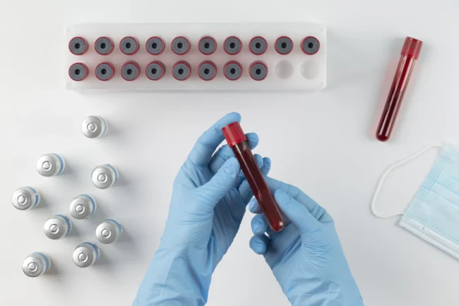 Miért van szükség vérvételre? Lotusz Medical Center labordiagnosztika.