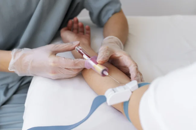 Vérvétel menete lépésről-lépésre a Lotusz Medical Centerben Budapesten.