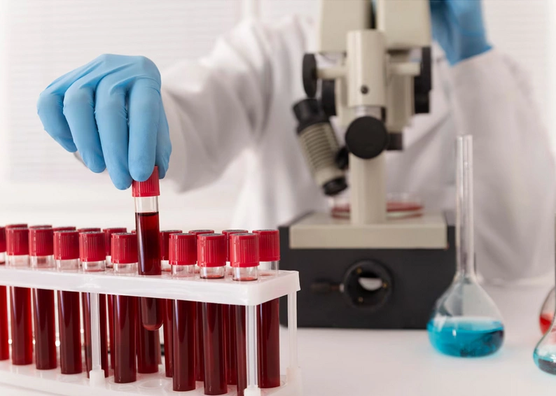 nagyrutin laborvizsgálat