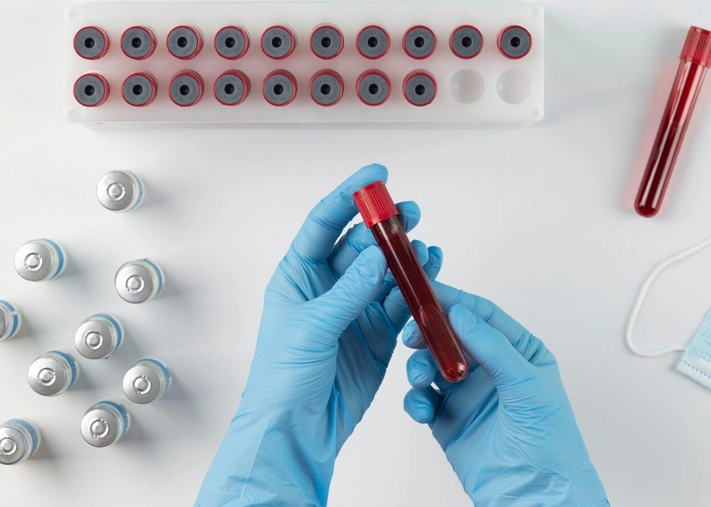 TSH érték a laboreredmény