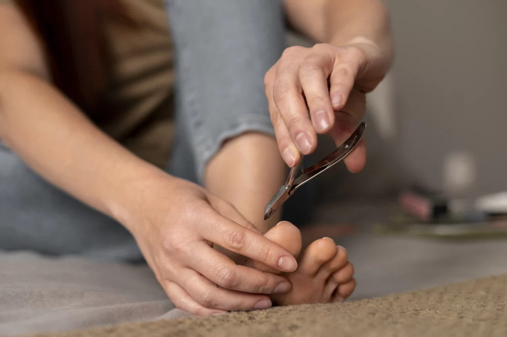 A benőtt köröm kezelése, megelőzése és kialakulásának okai