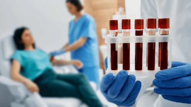GOT érték vizsgálata a labordiagnosztikában. Vérvétel a Lotusz Medical Centerben Budapesten.