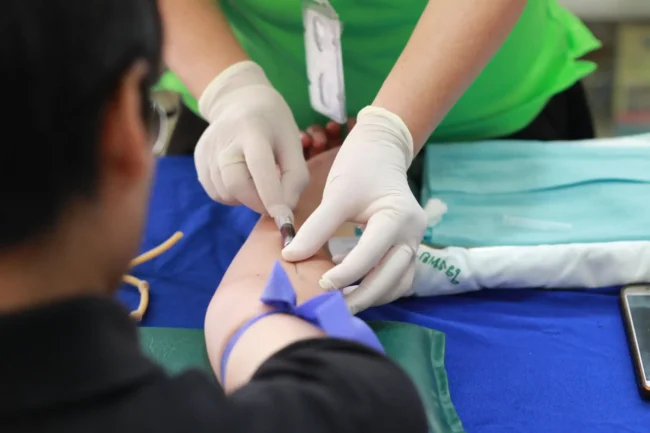 ldl-koleszterin Ldl koleszterin vizsgálat a Lotusz Medical Centerben.
