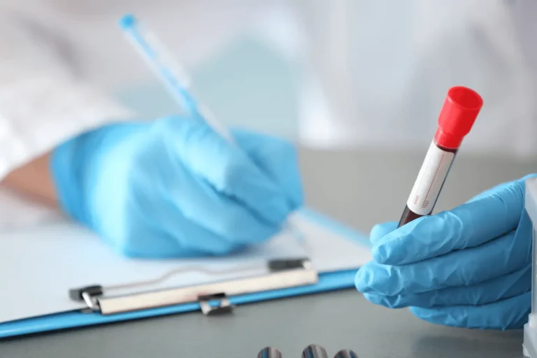 Kreatinin (Crea, Cre): a veseműködés legfontosabb értéke a vérképen