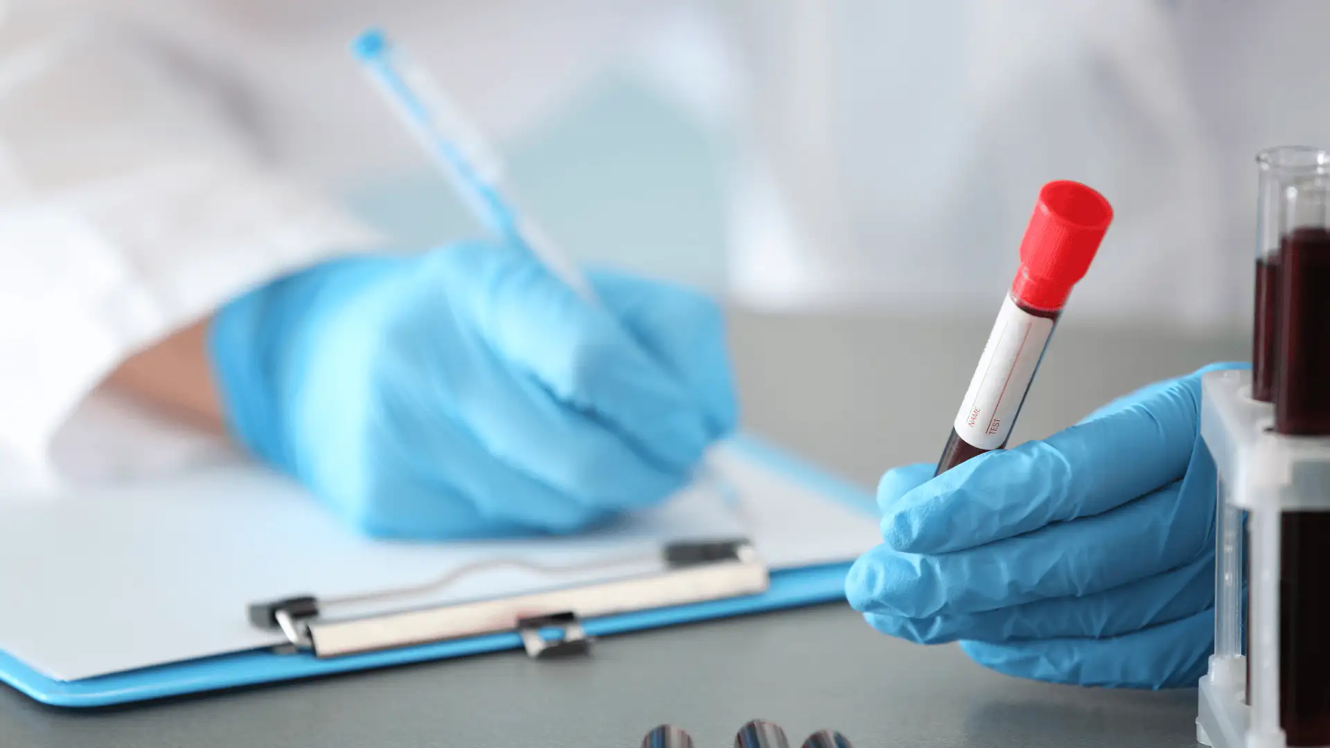 Kreatinin (Crea, Cre): a veseműködés legfontosabb értéke a vérképen