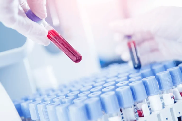 Vér karbamid-nitrogén (BUN) szint jelentése a laborleleten