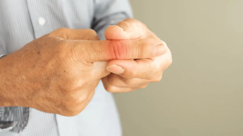Sokízületi gyulladás (polyarthritis)