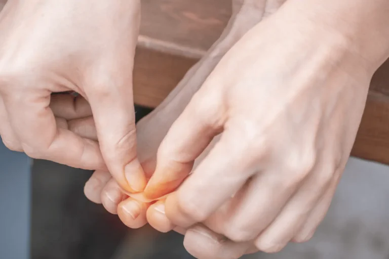 Begyulladt köröm eltávolítása sebészeti úton