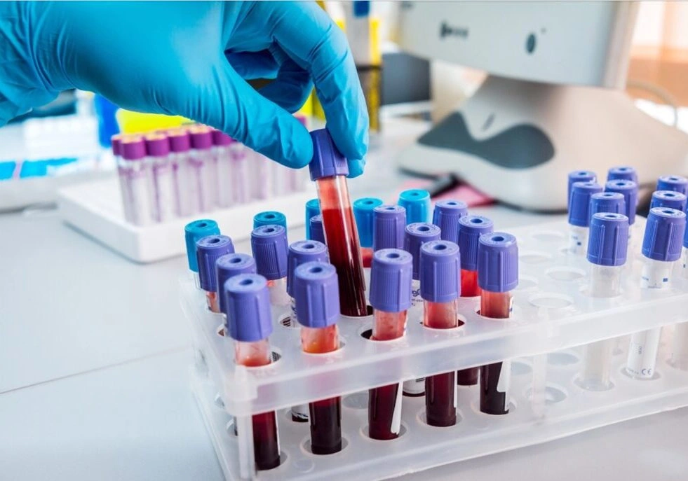 Vérvétel, labordiagnosztika