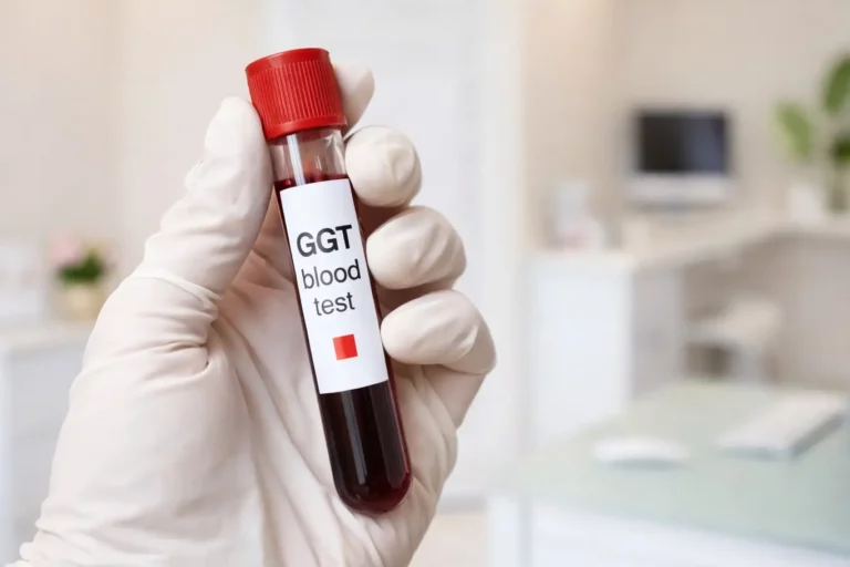 GGT vérvételi vizsgálat a Lotusz Medical Centerben